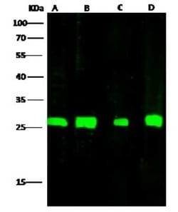 AK3L1 Antibody, Novus Biologicals 100 &mu;g; Unconjugated:Antibodies, Polyclonal