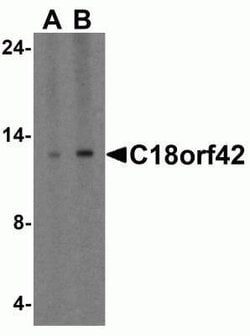 AKAIN1 Antibody - BSA Free, Novus Biologicals 0.1 mg | Buy Online | Novus Biologicals | Fisher Scientific