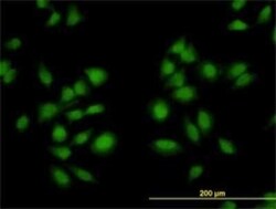 AKAP13 Antibody (5B7), Novus Biologicals 0.1 mg | Buy Online | Novus Biologicals | Fisher Scientific