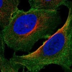 AKAP2 Rabbit anti-Human, Polyclonal, Novus Biologicals 25 &mu;g; Unconjugated:Antibodies,