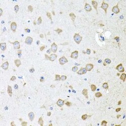 AKAP5 Antibody - BSA Free, Novus Biologicals:Antibodies:Primary Antibodies