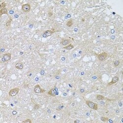 AKAP5 Antibody - BSA Free, Novus Biologicals:Antibodies:Primary Antibodies