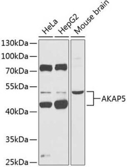 AKAP5 Antibody - BSA Free, Novus Biologicals 0.02 mL, Unconjugated:Antibodies,