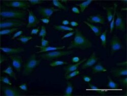AKAP9 Antibody (7E12), Novus Biologicals 0.1 mg, Unconjugated:Antibodies,