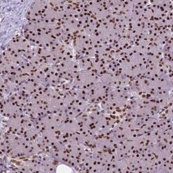 AKAP95/AKAP8 Antibody, Novus Biologicals:Antibodies:Primary Antibodies