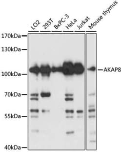 AKAP95/AKAP8 Antibody - Azide and BSA Free, Novus Biologicals 0.1 mL, Unconjugated:Antibodies,
