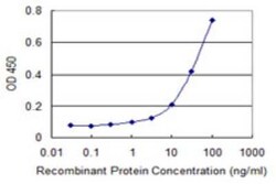 AKD1 Antibody (1H8), Novus Biologicals 0.1 mg | Buy Online | Novus Biologicals | Fisher Scientific