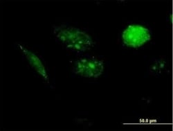 AKIP Antibody, Novus Biologicals 30 &mu;g; Unconjugated:Anticorps, Polyclonal