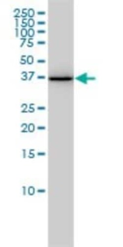 Novus Biologicals AKR1A1 Antibody (1A11-2A4), Novus Biologicals 0.1 mg | Buy Online | Novus Biologicals&trade; | Fisher Scientific