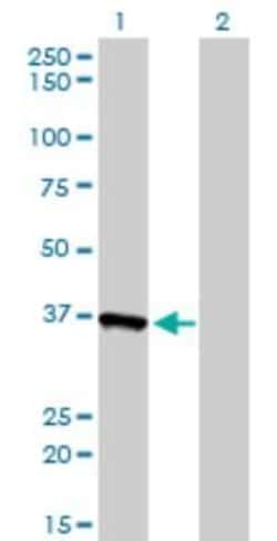 Novus Biologicals AKR1A1 Antibody (1A11-2A4), Novus Biologicals 0.1 mg | Buy Online | Novus Biologicals&trade; | Fisher Scientific