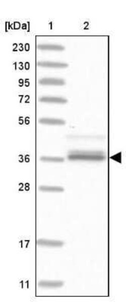 AKR1A1 Antibody, Novus Biologicals 0.1 mL; Unconjugated:Antibodies, Polyclonal