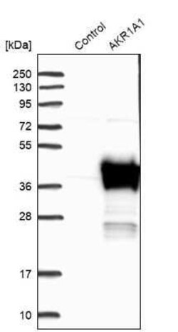 AKR1A1 Antibody, Novus Biologicals 25 &mu;L | Buy Online | Novus Biologicals | Fisher Scientific