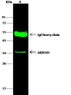 AKR1B1 Rabbit anti-Human, Clone: 109, Novus Biologicals:Antibodies:Primary