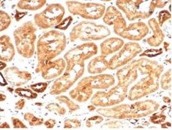 AKR1B1 Rabbit anti-Human, Clone: AKR1B1/7009R, Novus Biologicals 100 &mu;g;