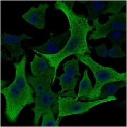 AKR1B1 Antibody (CPTC-AKR1B1-2) - Azide and BSA Free, Novus Biologicals