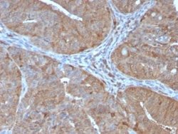 AKR1B1 Antibody (CPTC-AKR1B1-2) - Azide and BSA Free, Novus Biologicals