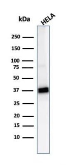 AKR1B1 Antibody (CPTC-AKR1B1-2) - Azide and BSA Free, Novus Biologicals