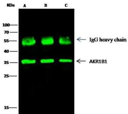 AKR1B1 Antibody, Novus Biologicals:Antibodies:Primary Antibodies