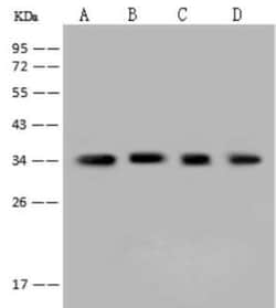 AKR1B1 Antibody, Novus Biologicals 50 &mu;g, Unconjugated:Antibodies, Polyclonal