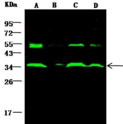 AKR1B1 Antibody, Novus Biologicals:Antibodies:Primary Antibodies