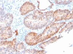 AKR1C2 Antibody (CPTC-AKR1C2-1) - Azide and BSA Free, Novus Biologicals