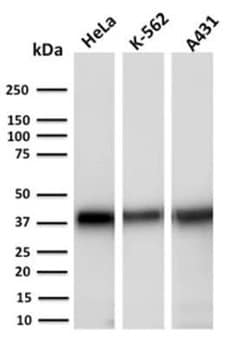 AKR1C2 Antibody (CPTC-AKR1C2-1) - Azide and BSA Free, Novus Biologicals