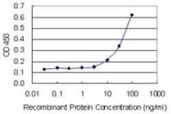 AKR1CL1 Antibody (4G8), Novus Biologicals 0.1 mg | Buy Online | Novus Biologicals | Fisher Scientific