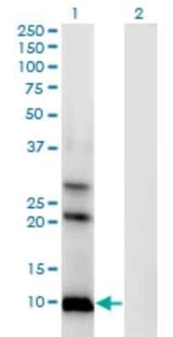 AKR1CL1 Antibody (4G8), Novus Biologicals 0.1 mg | Buy Online | Novus Biologicals | Fisher Scientific