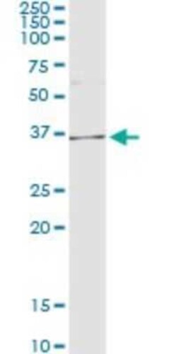 AKR1D1 Antibody (1A6), Novus Biologicals 0.1 mg | Buy Online | Novus Biologicals | Fisher Scientific