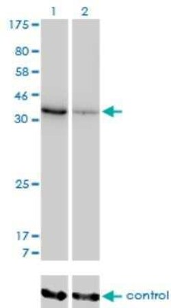 AKR1D1 Antibody (1C2), Novus Biologicals 0.1 mg | Buy Online | Novus Biologicals | Fisher Scientific
