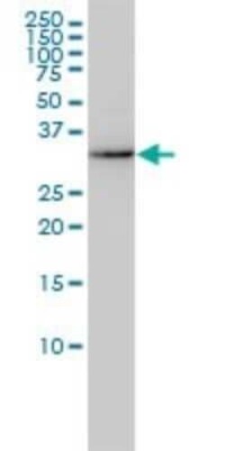 AKR7A2 Antibody (2A6), Novus Biologicals 0.1 mg | Buy Online | Novus Biologicals | Fisher Scientific