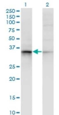 AKR7A2 Antibody (2H3), Novus Biologicals 0.1 mg | Buy Online | Novus Biologicals | Fisher Scientific