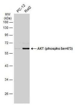 AKT, p Ser473 Antibody, Novus Biologicals 100 &mu;g | Buy Online | Bio-Techne | Fisher Scientific