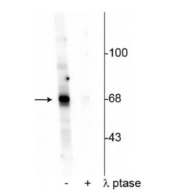 AKT, p Thr342 Antibody, Novus Biologicals 100&mu;L:Antibodies, Polyclonal