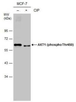 AKT, p Thr450 Antibody, Novus Biologicals 100 &mu;g | Buy Online | Novus Biologicals | Fisher Scientific