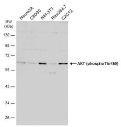 AKT, p Thr450 Antibody, Novus Biologicals 100 &mu;g | Buy Online | Novus Biologicals | Fisher Scientific