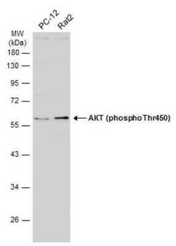 AKT, p Thr450 Antibody, Novus Biologicals 100 &mu;g | Buy Online | Novus Biologicals | Fisher Scientific