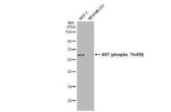 AKT, p Thr450 Antibody, Novus Biologicals 100 &mu;g | Buy Online | Novus Biologicals | Fisher Scientific