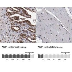AKT1 Antibody, Novus Biologicals 25 &mu;L | Buy Online | Novus Biologicals | Fisher Scientific