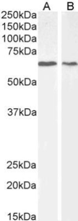 AKT1 Antibody, Novus Biologicals 100&mu;g:Antibodies, Polyclonal