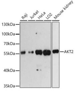 AKT2 Antibody - Azide and BSA Free, Novus Biologicals 100 &mu;g; Unconjugated:Antibodies,