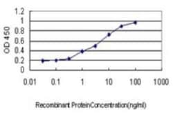 ALAS2 Antibody (6C1), Novus Biologicals 0.1 mg; Unconjugated:Antibodies,