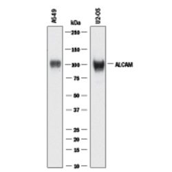 Human ALCAM/CD166 Antibody, R D Systems:Antibodies:Primary Antibodies