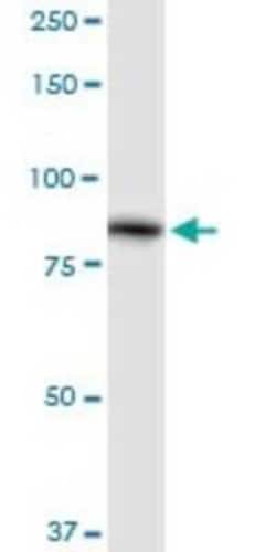 ALDH16A1 Antibody, Novus Biologicals 0.1 mg | Buy Online | Novus Biologicals | Fisher Scientific