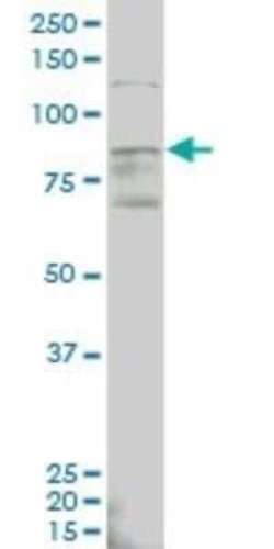 ALDH18A1 Antibody (2B5), Novus Biologicals 0.1 mg | Buy Online | Novus Biologicals | Fisher Scientific