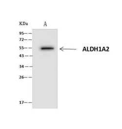 ALDH1A2 Antibody, Novus Biologicals:Antibodies:Primary Antibodies