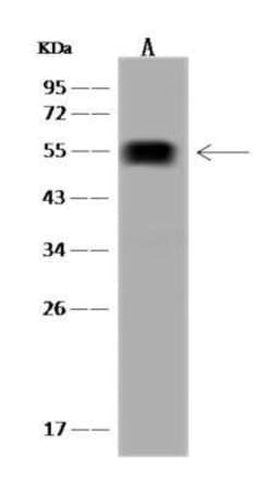 ALDH1A2 Antibody, Novus Biologicals:Antibodies:Primary Antibodies