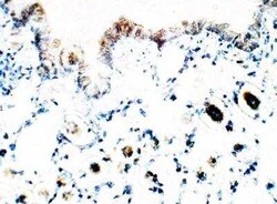 ALDH1A3 Antibody, Novus Biologicals 100 &mu;g | Buy Online | Novus Biologicals | Fisher Scientific