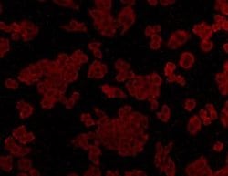 ALDH2 Mouse anti-Human, Clone: 7-D8, Novus Biologicals 100&mu;L:Antibodies,