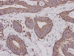 ALDH2 Mouse anti-Human, Clone: 7-D8, Novus Biologicals 100&mu;L:Antibodies,